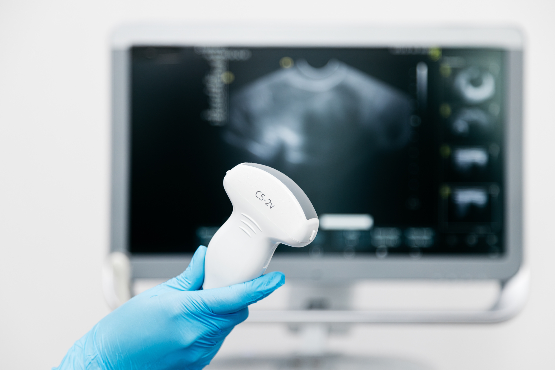 ultrasound3